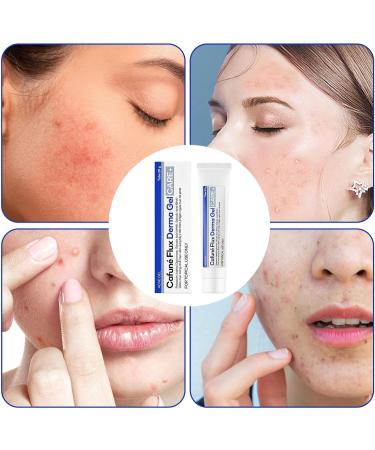  Generisch Spot Treatment Gel | Non-Greasy and Easy-to-Remove Solution | Facial Pimple Removal Gel For Women Family Friends Colleagues Travel Daily Use Nighttime Morning - Buy Online on GoSupps.com