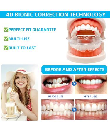 Adults Night Mouth Guard for Teeth Clenching & Grinding - Set of 3 Athletic Trays - Buy Online on GoSupps.com