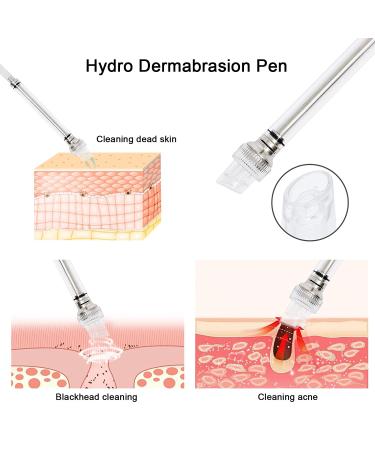 Aimengxi 3 in 1 Diamond Microdermabrasion Machine - Powerful Skin Care Device for Salon and Home Use - Buy Online on GoSupps.com
