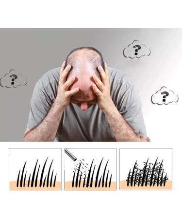 Hair Fiber in Talc - Buy Online on GoSupps.com
