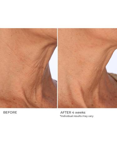 Age Defying Neck & Decollete Treatment Serum - Firm & Tighten Sagging Skin | Best Neck Wrinkle Serum - Buy Online on GoSupps.com