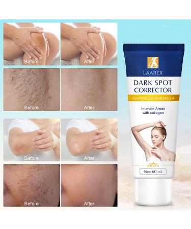 LAAREX Dark Spot Corrector for Body - Underarm, Neck, Armpit, Knees, Elbows, Private Parts - Intimate Areas Inner Thigh - 60ML - Buy Online on GoSupps.com