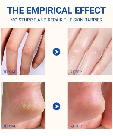 GAOMESIA Urea 60 foot cream 40 g intensive moisture care against calluses for dry and cracked feet heels and elbows foot care cream with aloe vera - Buy Online on GoSupps.com