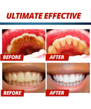 Natural Whitening Toothpaste with Baking Soda - Fluoride-Free Stain Removal & Gum Health (Blueberry Flavor) - International Shipping Available - Buy Online on GoSupps.com
