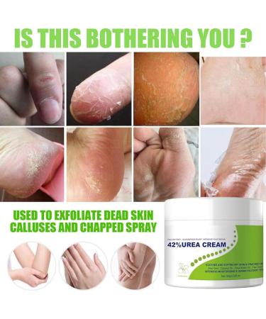 Urea Foot Cream Urea 42% Foot Cream Foot Moisturiser Feet Cream For Dry Cracked Skin Hard Skin Remover Heel Cream 42% Urea Cream & 2% Salicylic Acid Dry Feet Cream Cracked Heel Repair Cream Foot Balm - Buy Online on GoSupps.com