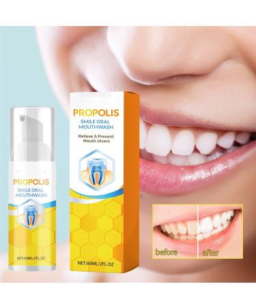 2PC Propolis Oral Instant Treatment Spray - Refreshing Breath & Complete Oral Health Care | Tooth Whitening Mouthwash - Buy Online on GoSupps.com