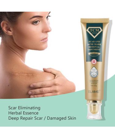 JSBNQRMZ Scar Gel 30g Scar Creme Reduces Scars Visibility & Reduces Tissue Tension & Itching - All Types of Scars - Buy Online on GoSupps.com