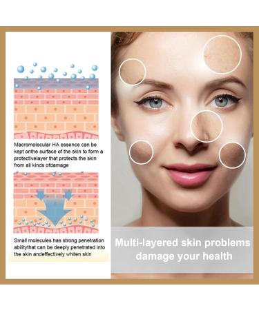 100ml Glycolic Acid 7% Toning Resurfacing Solution Glycolic Acid Toner Hydrating Toning Solution Glycolic Acid 7% Toning Solution Glycolic Acid Serum Face Serum for Women Glycolic Acid Peel for Acne - Buy Online on GoSupps.com