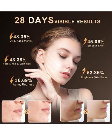 Lovsheme LED Face Mask - Professional Grade Skincare at Home FDA Approved Red Light Therapy Mask for Acne Wrinkles and Skin Rejuvenation 3 Light Modes Remote Control Includes Eye Protection - Buy Online on GoSupps.com