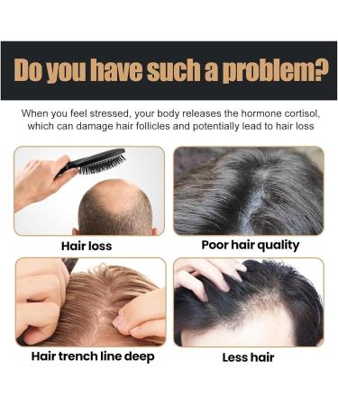 Revitalizing Root Shampoo Anti-Hair Loss Shampoo Thick Hair Shampoo Strong Repair Shampoo Unisex - Buy Online on GoSupps.com