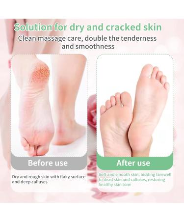4 Pieces Double-Sided Foot File Foot Rasp File Dead Skin Remover Foot Scrubber Disposable Foot Rasp Manicure File Callus Hard Skin Remover for Dry Cracked Feet Dead Skin Calluses Cracks - Buy Online on GoSupps.com