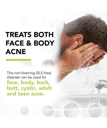 Regular-Strength Acne Wash with 5% Benzoyl Peroxide - 8 Fl Oz | For Face, Skin, Body | Dermatologist-Tested Non-Foaming Cleanser | Vegan & Cruelty-Free - Buy Online on GoSupps.com