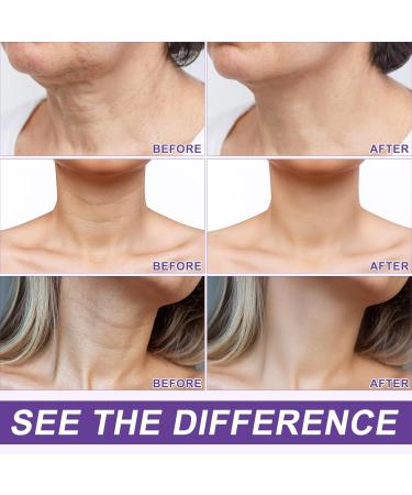 Uocasi AH8 Neck Firming Cream Firm TightLift Neck Cream with 360 Roller MassageReduce Wrinkles Fine Lines and Double ChinFirm and Lift Sagging SkinHydration Skin Tightening Cream120g - Buy Online on GoSupps.com