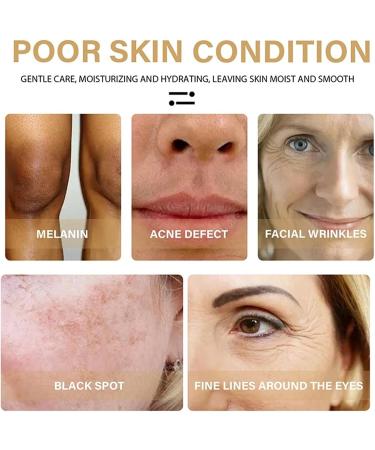 Turmeric face seruem Dark Spot Remover Essence Turmeric Serums for face Brightens Skin Tone Moisturizes Hydrates Lightens Age-Spots Acne Reduce Fine Lines Facial Care Anti-Aging Serum - Buy Online on GoSupps.com