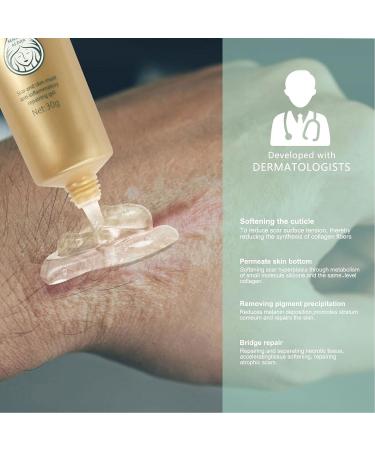 Scar Removal Cream - 30g - Fade Scars, Stretch Marks & Burns - Moisturizing Facial Skin Repair Treatment - Buy Online on GoSupps.com