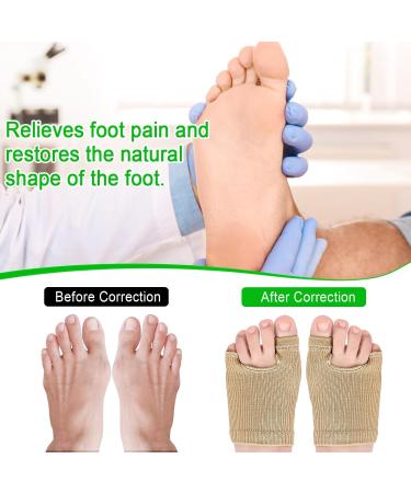 Buy Bale Toe Support - Gel Pads for Effective Protection & Relief from Inflamed Balls | International Shipping - Buy Online on GoSupps.com