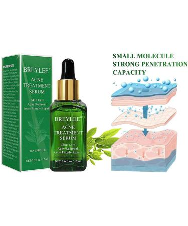 Tea Tree Acne Treatment Serum 17ml - Clear Severe Acne Breakouts and Repair Skin | Pimple Remover - 0.6 Fl Oz - Buy Online on GoSupps.com