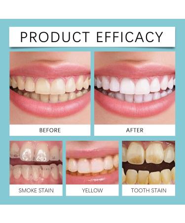 KLYso Gentle Teeth Cleaning Powder - Stain Remover Long-Lasting Freshness Oral Care Essential(1PCS) - Buy Online on GoSupps.com