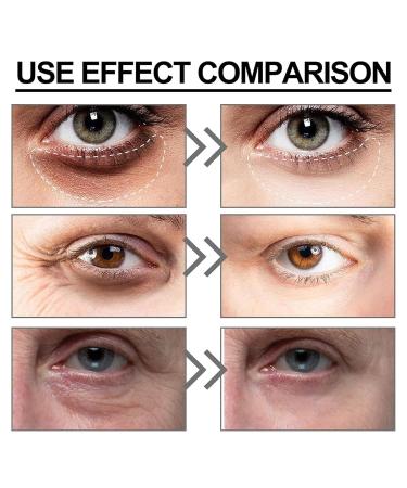 Buy Time Eraser Rollerball for Eyes - Reduce Wrinkles Dark Circles & Puffiness | 3PCS Under Eye Oil Roller - International Shipping Available - Buy Online on GoSupps.com