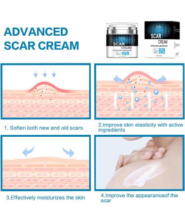 Scar Removal Cream - Repair & Moisturize Old/New Scars, for Male/Female, Surgery/Scald/Burns - 1.85 FL OZ - Buy Online on GoSupps.com