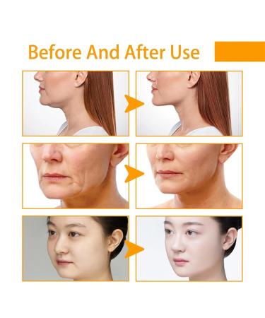 Buy Turmeric Face Cream - Anti-Aging Hydrating Cream with Vitamin C for All Skin Types | Natural Firming & Tightening Repair - Buy Online on GoSupps.com