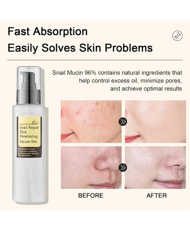 Advanced Snail Mucin 96% Power Repairing Essence | Hydrating Anti-Aging Face Serum for All Skin Types - Buy Online on GoSupps.com