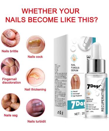 Extra Strong Fungal Nail Treatment for Toenails - Nail Fungus Care Solution - Repair & Renew Damaged Nails - Buy Online on GoSupps.com