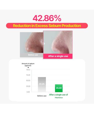 O!GETi HeartCica Ampoule Toner, Calming & Hydrating Toner, Heartleaf & CICA Extracts, Triple Patented Sebum Control, 5.1 fl.oz - Buy Online on GoSupps.com