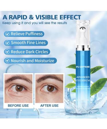 Allony Caffeine Eye Cream Eye Cream for Dark Circles and Puffy Eyes Eye Cream Anti Aging Eye Bags Remover Moisturizing Firming and Anti-wrinkle(20ml) - Buy Online on GoSupps.com