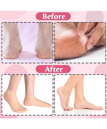 3 Pair Silicone Gel Moisturizing Socks for Dry Feet & Cracked Heels - Large Size - Buy Online on GoSupps.com