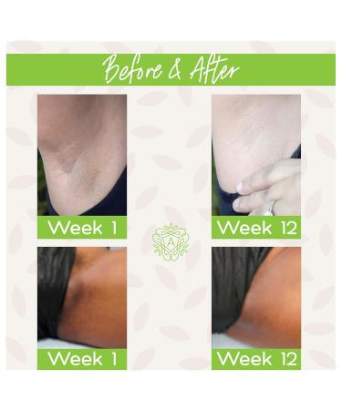 Amaira Brightening Accelerator Wash - Gentle Exfoliating Cleanser for Sensitive Areas | Natural & Plant-Based | Brightens Dark Spots & Evens Skin Tone (2 fl oz - Buy Online on GoSupps.com