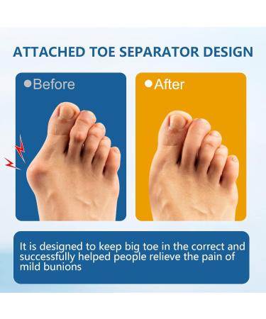 Sumifun Clear Gel Bunion Cushion Protector - 12 Pack | Relieve Foot Pain | Realign Big Toe | Bunion Corrector for Men or Women (Blue) - Buy Online on GoSupps.com