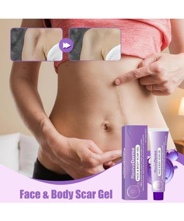 Scar gel for the body 28 gram solution for all skin types smoothing scar angel for the body skin for adults women men teenagers seniors arms legs hands and neck - Buy Online on GoSupps.com