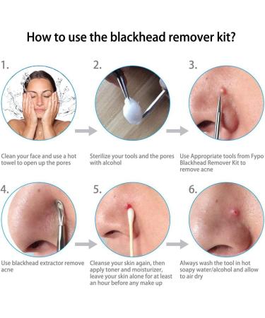Blackhead Remover Kit LightBiz Extractor Removal Set 5Pcs Professional Stainless Steel Pimple Popper Tool Treatment for Whitehead Blemish Acne Comedone Pimple Popping - Buy Online on GoSupps.com