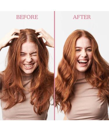 Umberto Giannini Scalp Rescue Anti Dandruff Hair and Scalp Mask - Vegan & Cruelty Free - 150ml - Buy Online on GoSupps.com