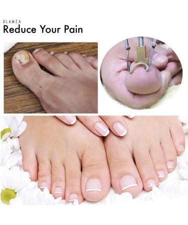 GLAMZA Ingrown Toenail Corrector Clamp - Safe & Effective Treatment Tool - Buy Online on GoSupps.com