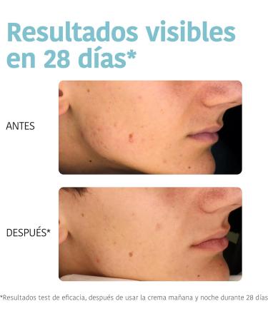 Sensalia Labs Iroha Nature Oil Control Cream with Salicylic Acid Zinc PCA and Niacinamid Face Cream with AcneTrend reduces pimples and moisture 94 Natural Ingredients Oil Control Cream - Buy Online on GoSupps.com