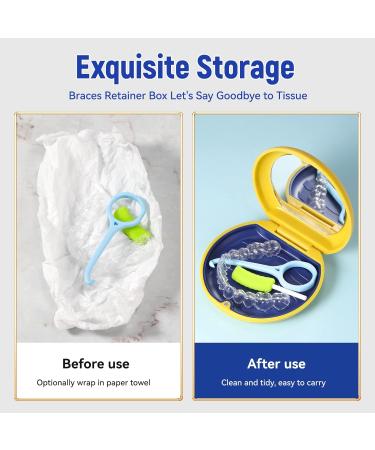 Annhua Dental Mouth Protection Case & Orthodontic Holder - White | Denture Holder Box with Mirror for Safe Storage - Buy Online on GoSupps.com