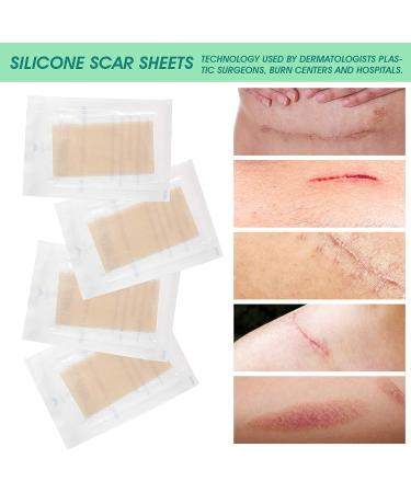 Silicone Scar Removal Sheets for C-Section Surgery, Burns, Acne, Keloids & Stretch Marks - Washable & Reusable - Effective on Old & New Scars - 4 Pack - Buy Online on GoSupps.com
