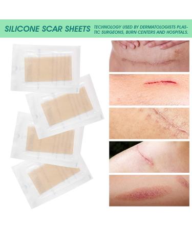 Silicone Scar Sheets - Surgical/Burn Scar Removal Treatment - 4PCs - Buy Online on GoSupps.com