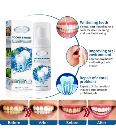 Brightening Mousse Toothpaste - Effectively Whitens and Removes Stains Freshens Breath and Repairs Gums. Two Convenient Application Methods to Safeguard Oral Health(3pcs) - Buy Online on GoSupps.com