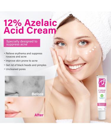 SCOBUTY Azelaic Acid Face Serum Cream Brightening Face Skin Care Treatment and Repair Dark Spots for All Skin Types 20ml 20 g (Pack of 1) - Buy Online on GoSupps.com