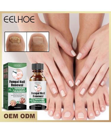 MrCuvaryas Nail Serum for Toenails Extra Strong - Buy Online on GoSupps.com