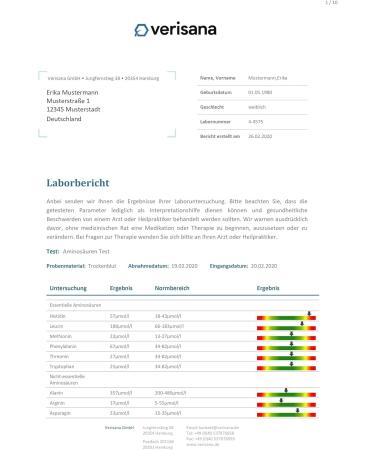 Amino Acid Test for 18 Amino Acids - Comprehensive Aminogram with Essential Amino Acids Leucine Methionine Phenylalanine Threonine Tryptophan & Valine - International Shipping - Buy Online on GoSupps.com