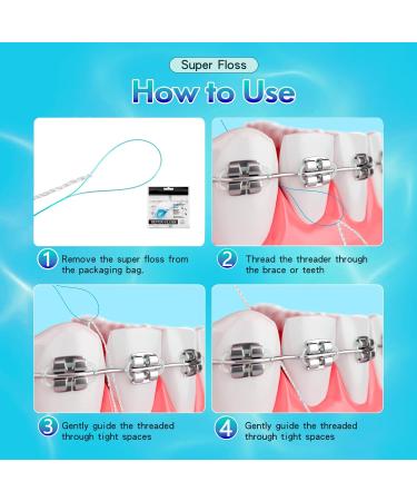 Super Floss Threaders - 30PCS Periodontal & Orthodontic Floss for Gum Health & Implant Care - Buy Online on GoSupps.com