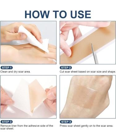 Silicone Scar Sheets(1.6"x115"-2.9M) Medical Grade Silicone Scar Tape Silicone Strips for Scar Healing Painless Scar Removal Tape for All Surgical Incisions C-Section Burn Keloid Acne 1.6"x115"-2.9M 1.6"x115"-2.9m - Buy Online on GoSupps.com