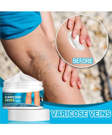 Cr me Apaisante pour les Jambes Creme Anti Varices Cr me pour Varices R paration des Jambes d'Araign e Varices Jambes Cr me Creme Anti Varices Cr me de Soin Hydratante Jambes 30G - Buy Online on GoSupps.com