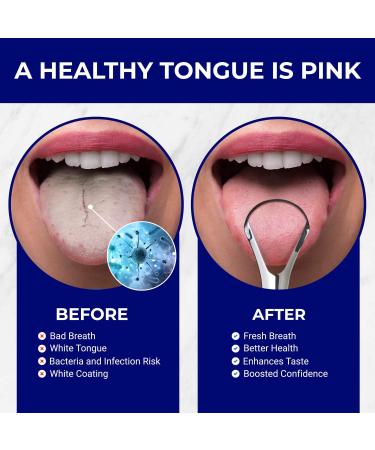 Stainless Steel Tongue Scraper for Fresh Breath and Oral Health - ORAVIX - Buy Online on GoSupps.com