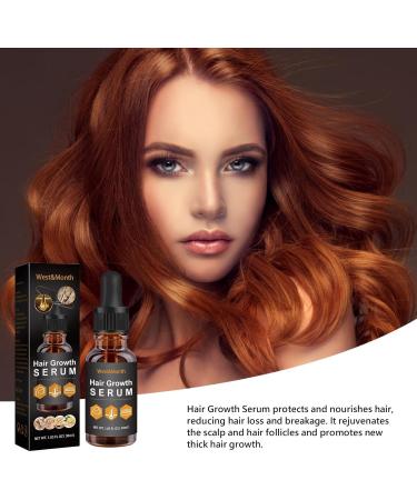 Nourishing Hair Fertilizer | Biotin for Hair Growth | Hair Repair Lotion | Hair Growth and Repair Lotion Moisturizing Hair Lotion Hair Revitalizer for Damaged Hair - Buy Online on GoSupps.com