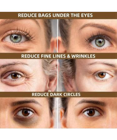 17ml Snail Peptide Energetic Eye Roll-On Firming Eye Cream Eye Cream for Dark Circles and Puffy Eyes Anti Wrinkle Eye Cream Under Eye Cream Eye Cream Anti Aging Puffy Eyes Instant Eye Bag Removal - Buy Online on GoSupps.com